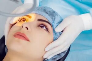 Cataract Surgery